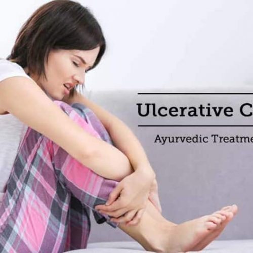 Ulcerative Colitis